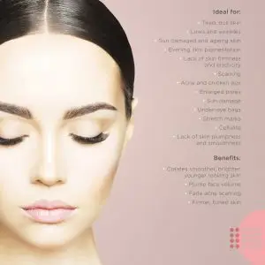 Glow Needling A3 Poster